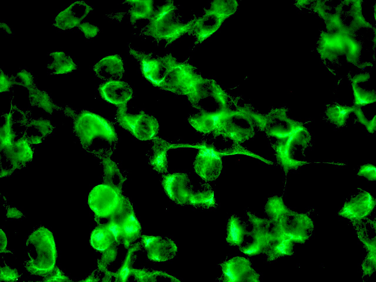 Figure 3 Immunostaining of intracellular nestin filaments in cultured SH-SY-5Y neuronal cells using MUB1302P (1:100 dilution).